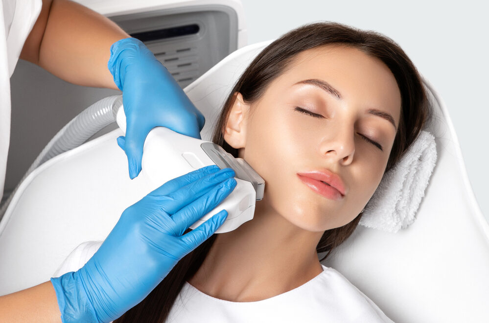 photofacial treatments